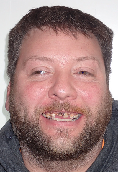 B&A-Face-Don-Before