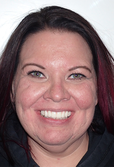 B&A-Face-Jessica-AfterB&A-Face-Jessica-After