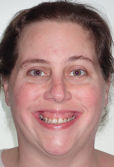 B&A-Face-Kelly-Before B&A-Face-Kelly-Before