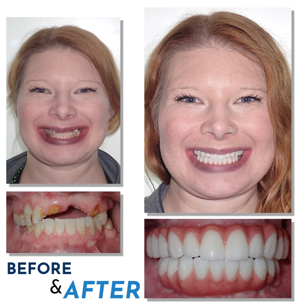 B&A-Face-Laura 2-Before & After