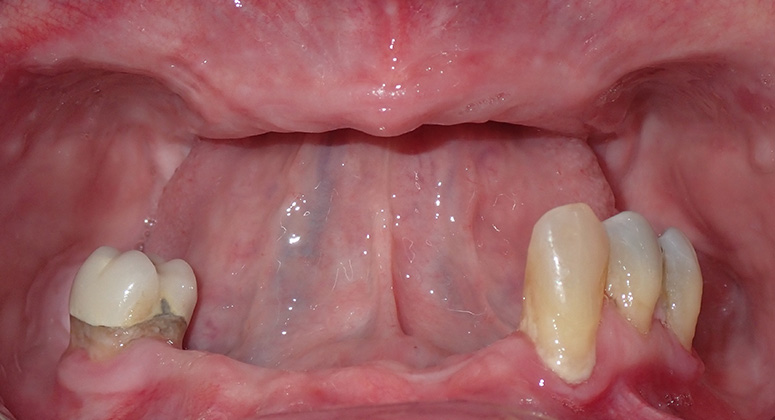 B&A-Teeth-Barb-Before