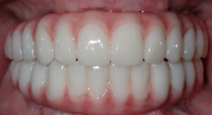 B&A-Teeth-Beth-After