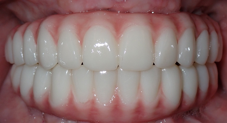 B&A-Teeth-Beth-After
