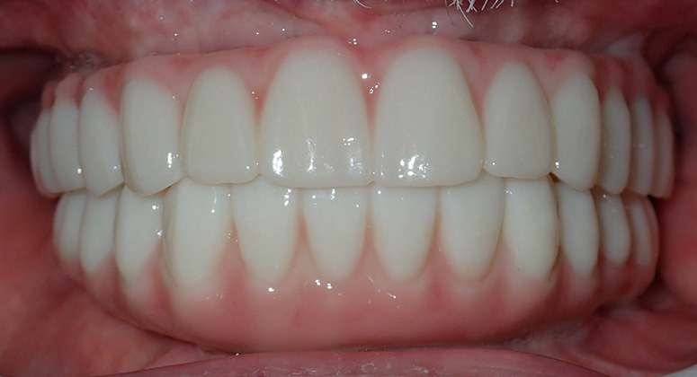 B&A-Teeth-Dave 3-After