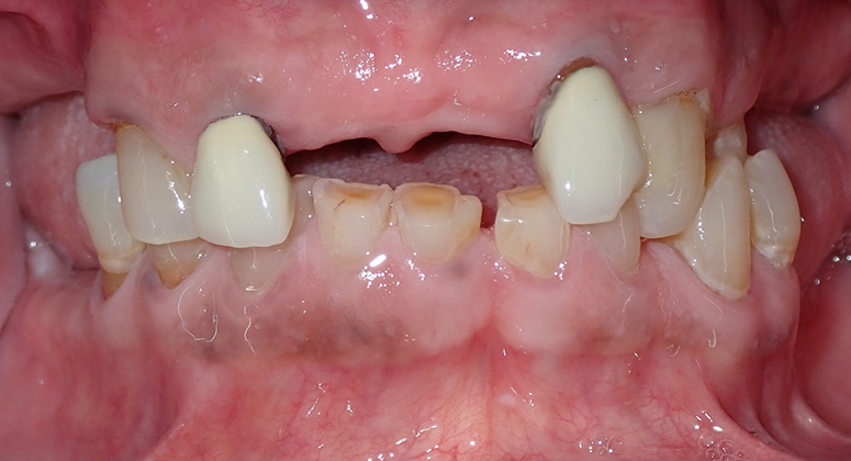 B&A-Teeth-Everton-Before B&A-Teeth-Everton-Before