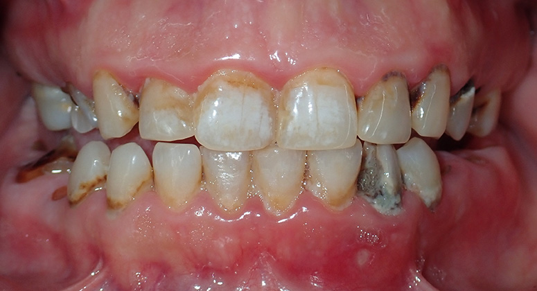 B&A-Teeth-Kelly-Before B&A-Teeth-Kelly-Before
