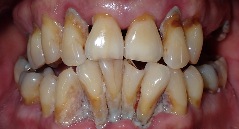 Richard-teeth-before