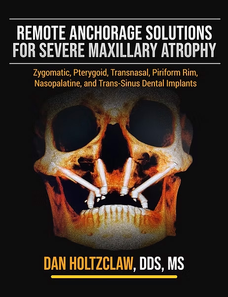 Zygomatic implant clinical textbook co-authored by Dr. Igor Kaplansky