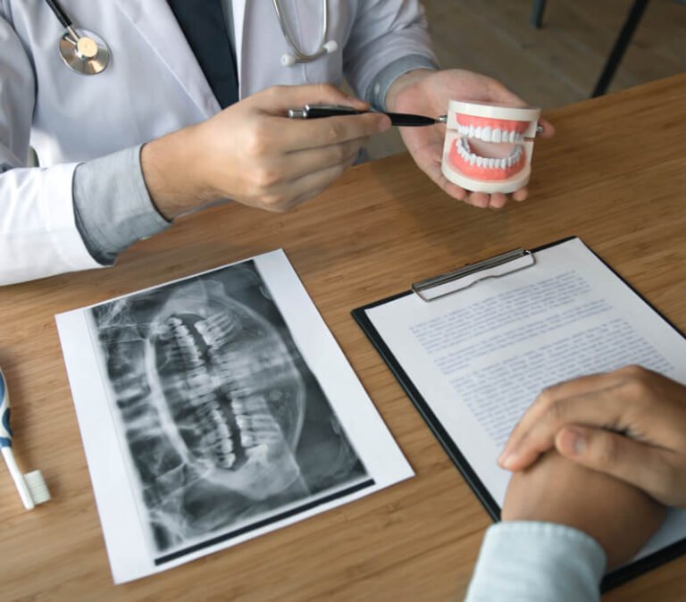 How to Care for Your Dental Implants A Comprehensive Guide