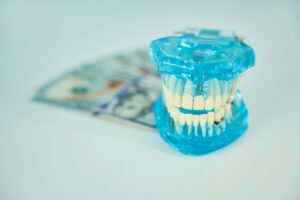 Dental Implants- How Much Do They Really Cost