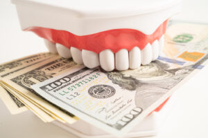 How Much Are Complete Dental Implants Compared to Other Options
