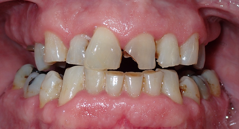 Douglas-Teeth-Before